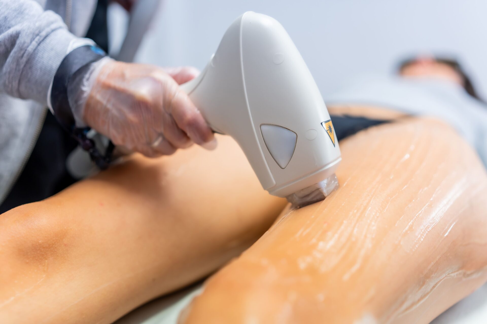 Close up of woman leg laser hair removal 2026 03 16 02 45 33 utc scaled.jpg